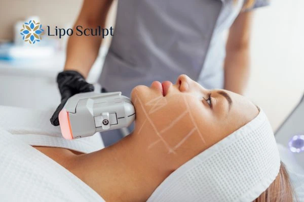 HIFU vs Botulinum Toxin: Understanding the Differences 1 HIFU vs Botox Worksop What is the best option for you?