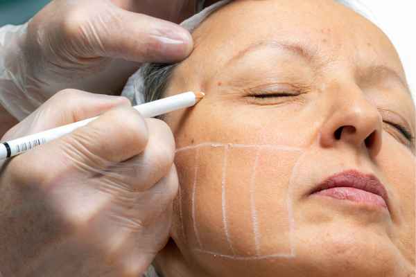 CryoPen: 5 Skin Concerns It May Be Used to Treat 4 What should you ask before having CryoPen treatment Worksop?