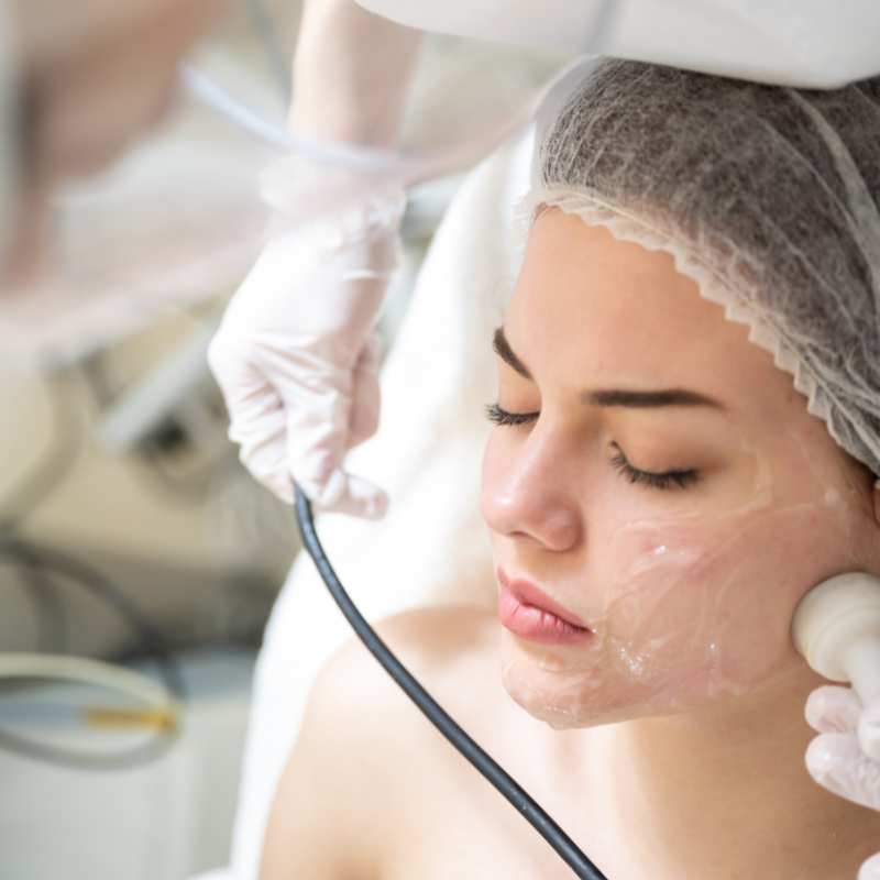 Why Do People Choose HIFU for a Non-Surgical Facelift? 5 What are the risks Worksop?