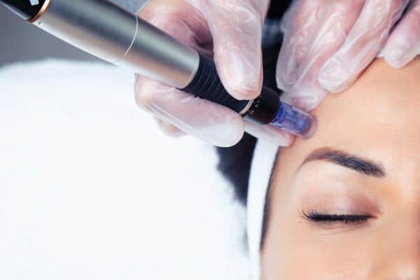Explaining Total Skin Tightening Treatment and What to Expect 2 What Skin Concerns Can Total Skin Tightening Treatment Help With Worksop?